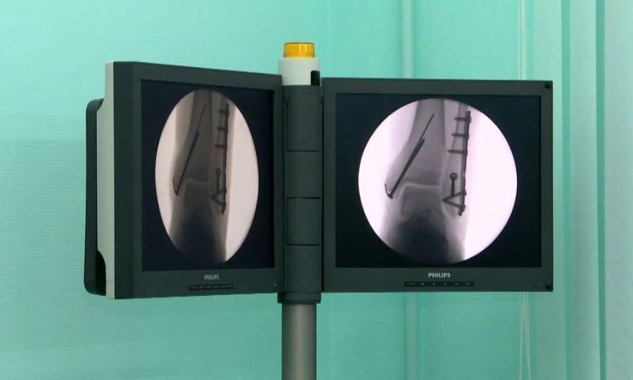В Коряжемскую городскую больницу поступило современное рентген-оборудование